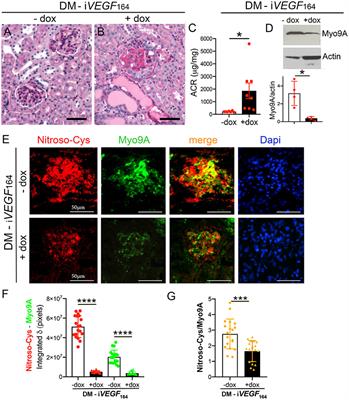 S-Nitrosylation of RhoGAP Myosin9A Is Altered in Advanced Diabetic Kidney Disease